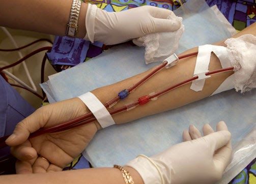 Understanding Dialysis Treatment
